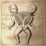 siamesetwindiagram 1