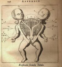 siamesetwindiagram 1