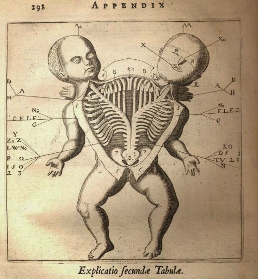siamesetwindiagram 1